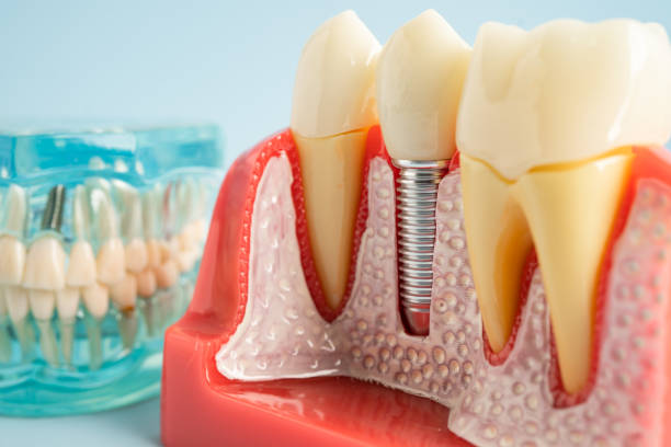 Best Periodontal (Gum) Disease Treatment  in East Lansing, MI